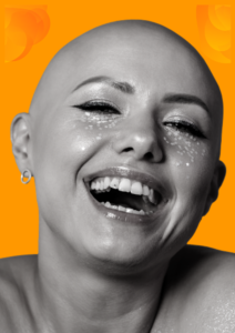 Alopecia Magazine UK