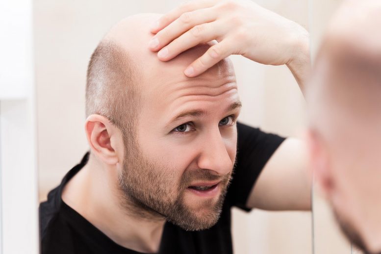 Alopecia Hair Heals